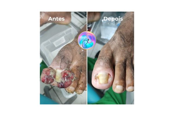 Foto de antes e depois do tratamento 40